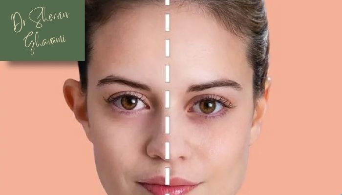 مزایای جراحی اصلاح گوش مزایای جراحی اصلاح گوش