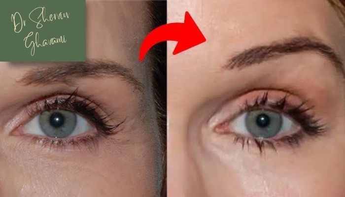 ریسک‌ها و عوارض احتمالی هر روش