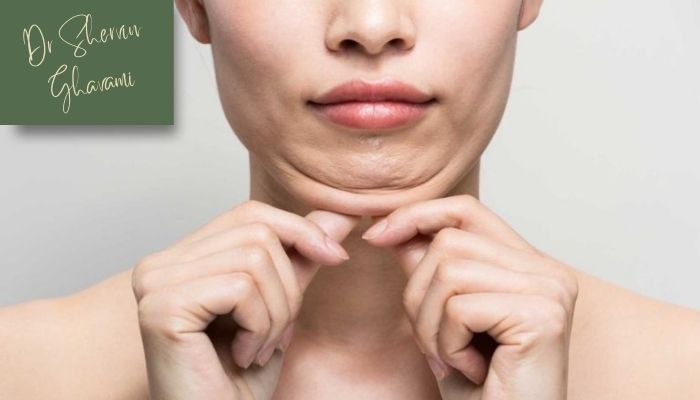 مراقبت‌های بعد از برداشتن چربی زیر چانه