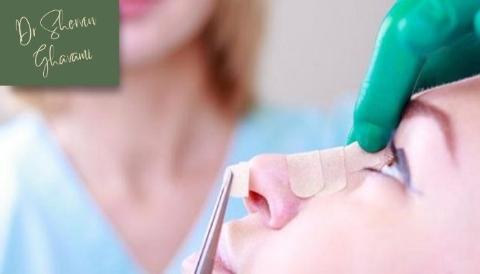 آیا عمل بینی بدون تامپون ممکن است؟ آیا عمل بینی بدون تامپون ممکن است؟