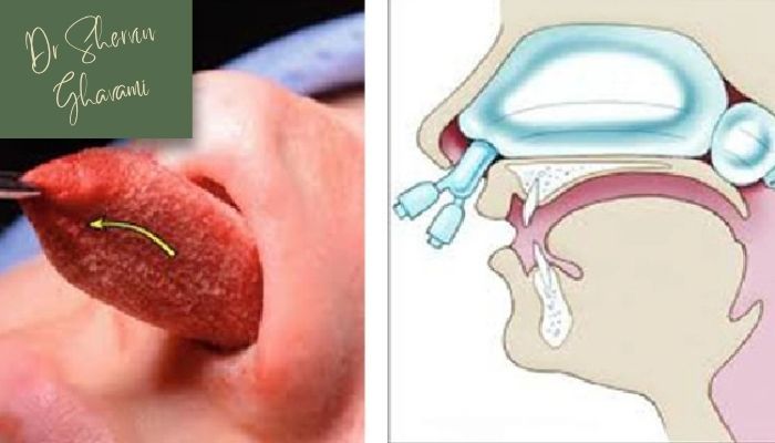 چرا تامپون بینی استفاده می شود؟ چرا تامپون بینی استفاده می شود؟