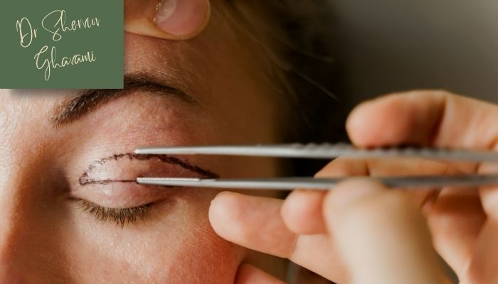 مقایسه بلفاروپلاستی با لیزر و جراحی سنتی