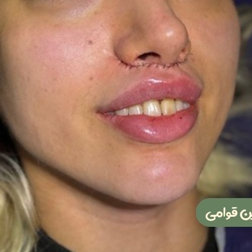 بعد از سانترال لب