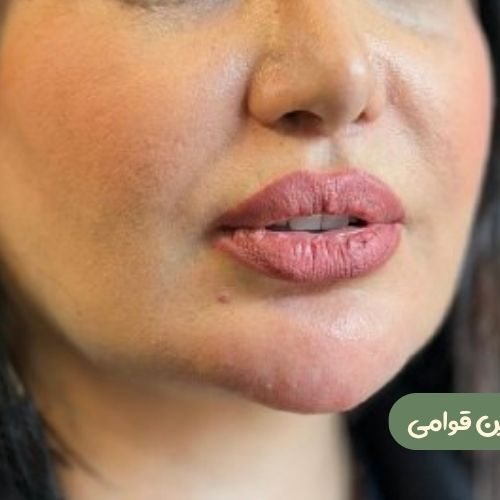 بعد از سانترال لب