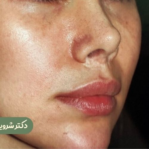 قبل از سانترال لب