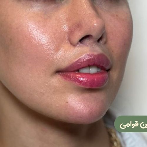 بعد از سانترال لب