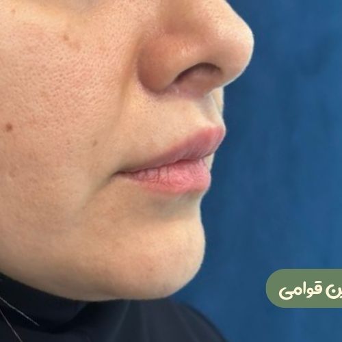 بعد از سانترال لب