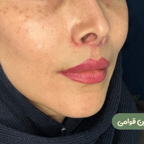 بعد از سانترال لب