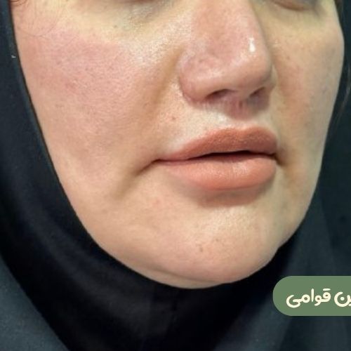 بعد از سانترال لب