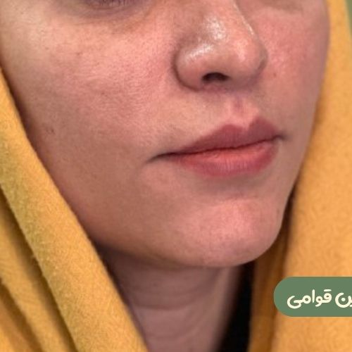 بعد از سانترال لب