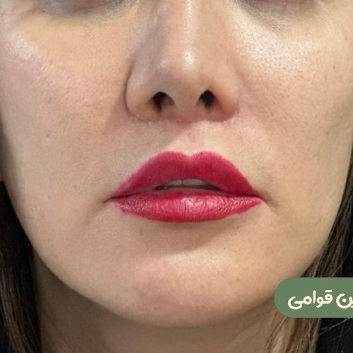 بعد از سانترال لب