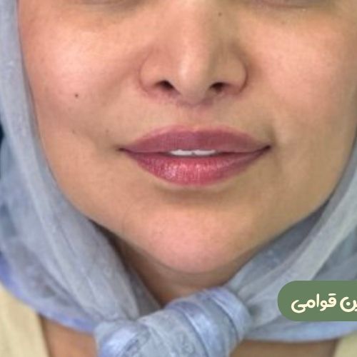 بعد از سانترال لب