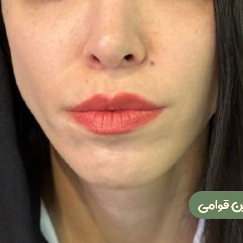 بعد از سانترال لب