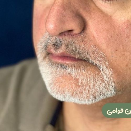 بعد از سانترال لب