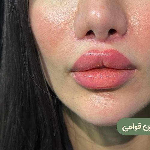 بعد از سانترال لب