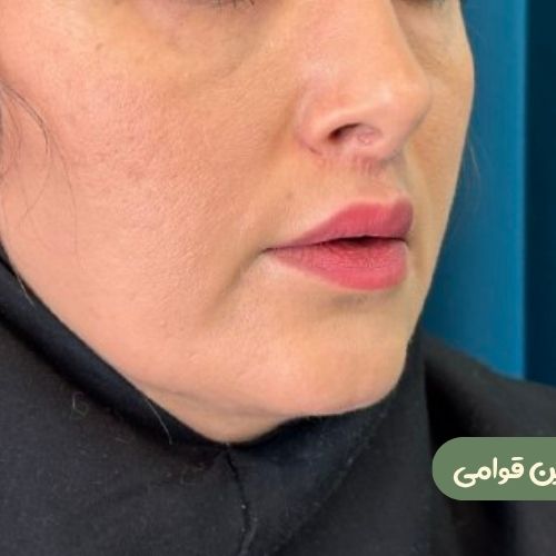 بعد از سانترال لب