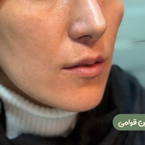 بعد از سانترال لب