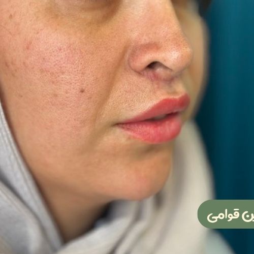 بعد از سانترال لب