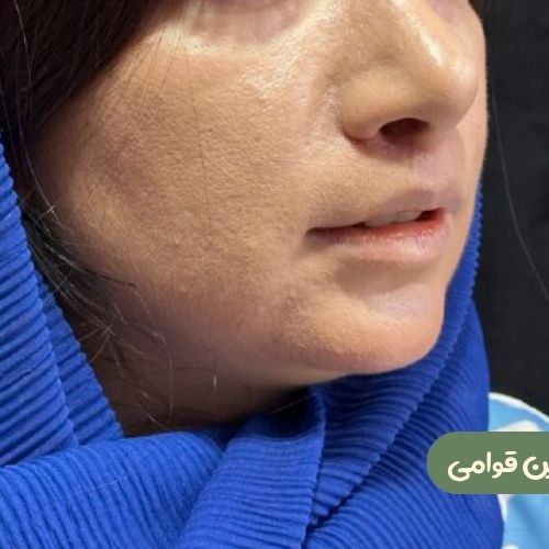 بعد از سانترال لب