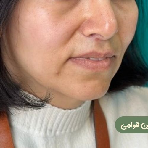 بعد از سانترال لب