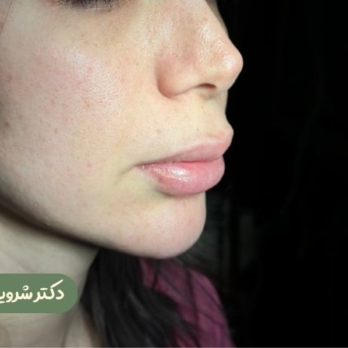 قبل از سانترال لب