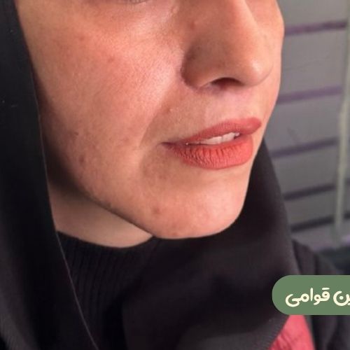 بعد از سانترال لب