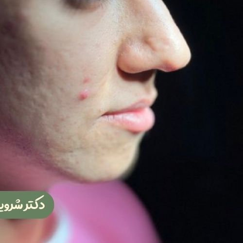 قبل از سانترال لب