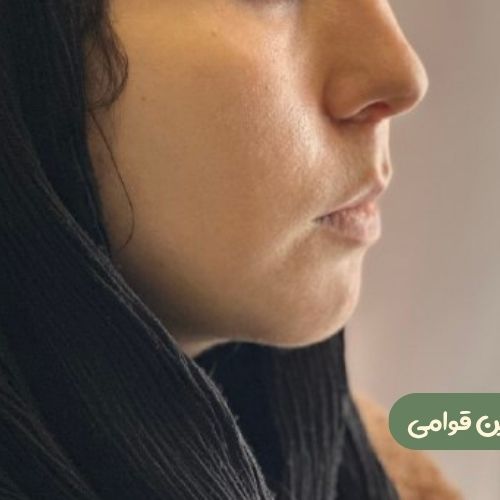 بعد از بوکال فت + ساکشن غبغب + ژنیوپلاستی