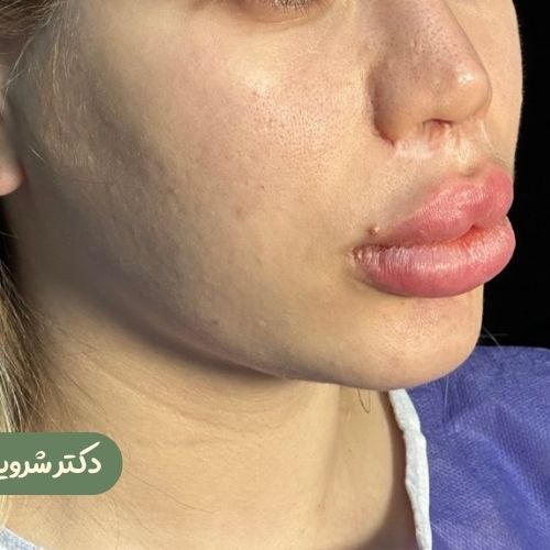 قبل از بوکال فت