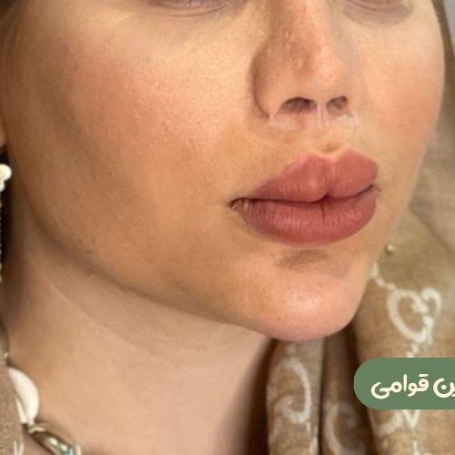 بعد از بوکال فت