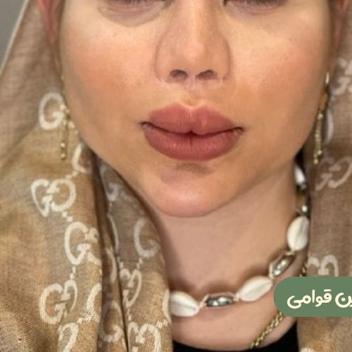 بعد از بوکال فت 