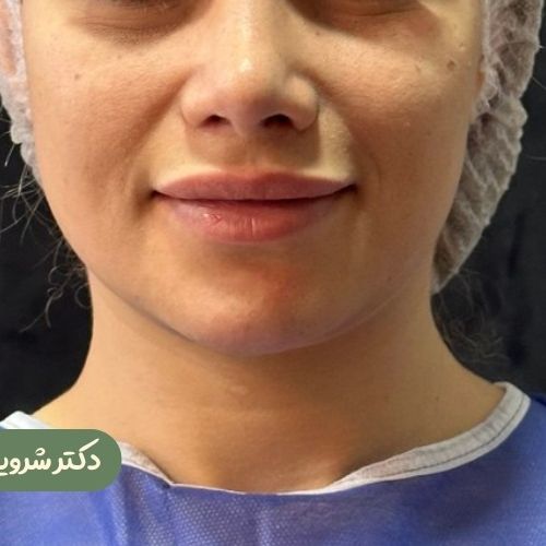 قبل از بوکال فت