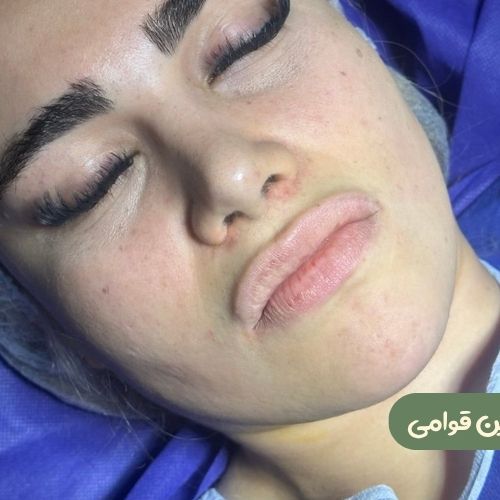 بعد از بوکال فت