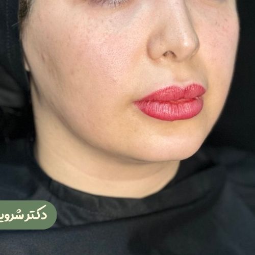 قبل از بوکال فت