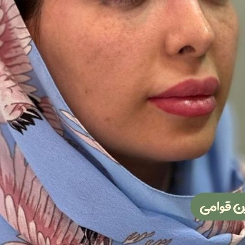 بعد از بوکال فت