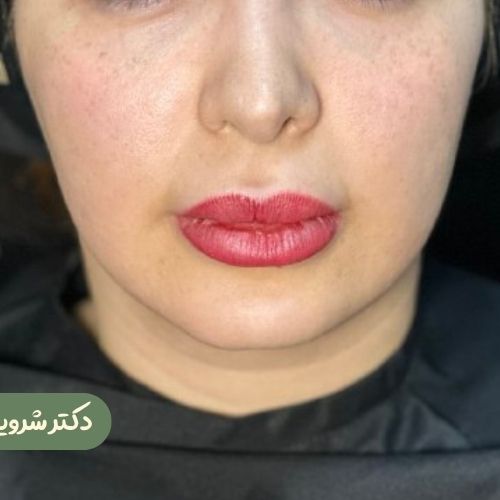 قبل از بوکال فت