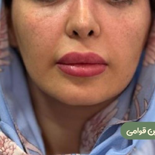 بعد از بوکال فت