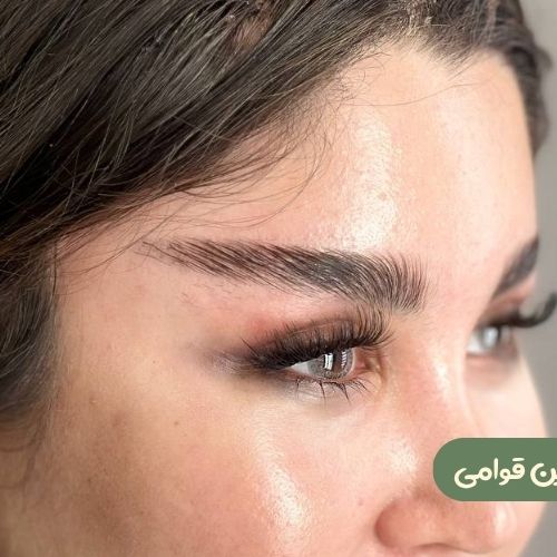 بعد از لیفت شقیقه