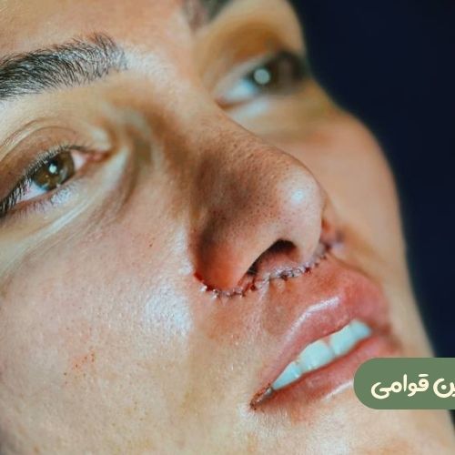 بعد از سانترال لب
