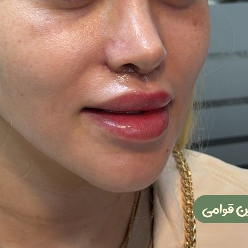 بعد از سانترال لب