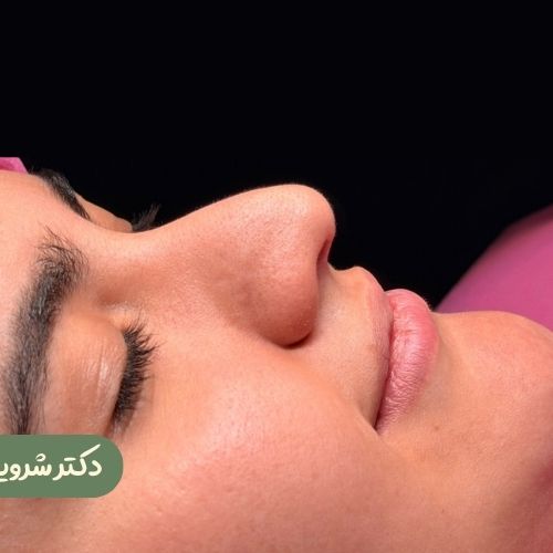قبل از رینوپلاستی