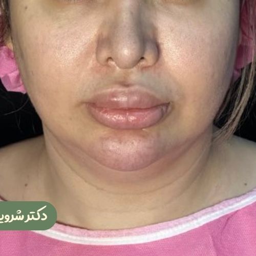 قبل از بوکال فت