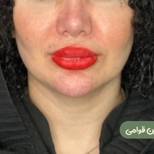 بعد از بوکال فت
