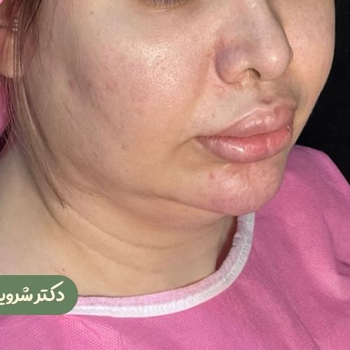 قبل از بوکال فت