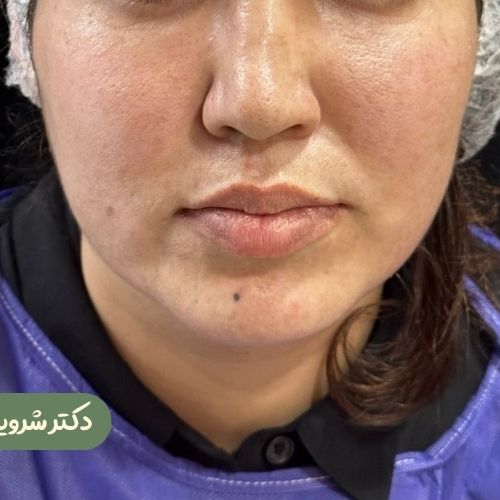 قبل از بوکال فت
