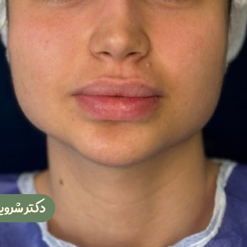 قبل از بوکال فت