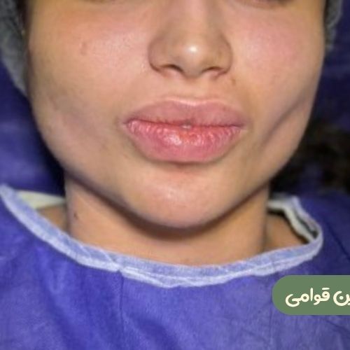 بعد از بوکال فت