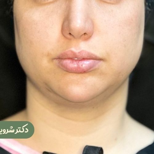 قبل از بوکال فت