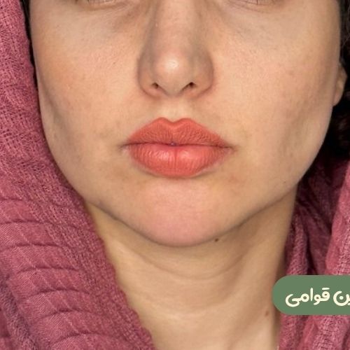بعد از بوکال فت