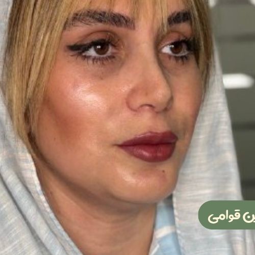 بعد از رینوپلاستی + ژنیوپلاستی